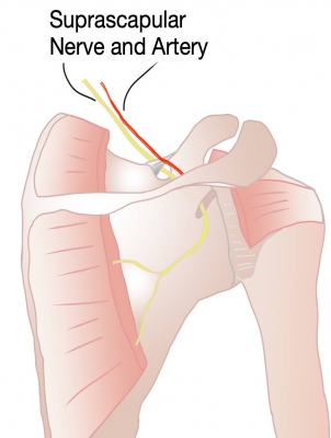 Pain in the back! (of the shoulder)