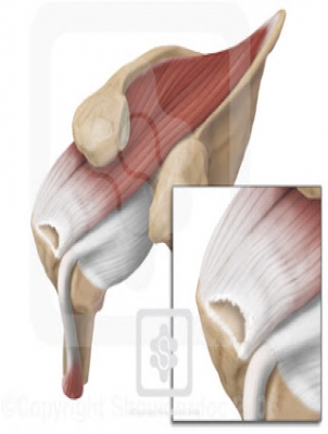 Should We Fix Your Rotator Cuff Tear?