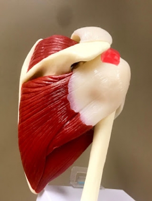 Subacromial Decompression Is No Better Than Sham Surgery.