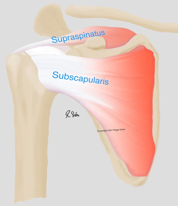 Partial Rotator Cuff Tears Fountain Valley  Shoulder Pain San Juan  Capistrano, San Clemente